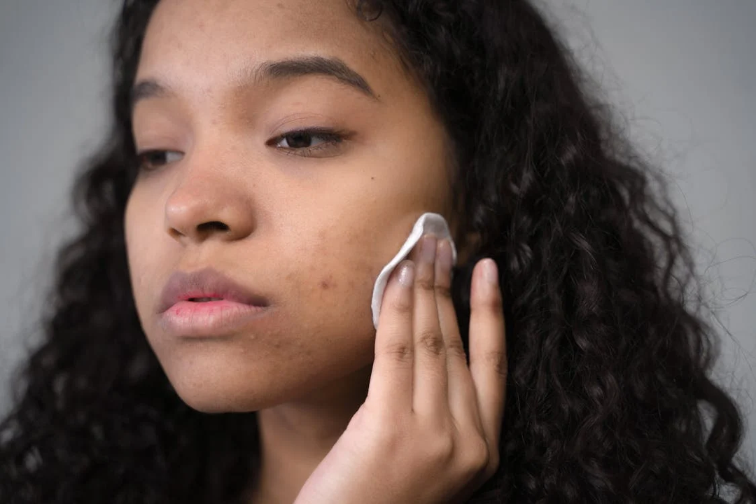 Young woman applying Lotion P50 PIGM 400 to her face for exfoliation and brightening, exploring the right frequency for flawless skin results.